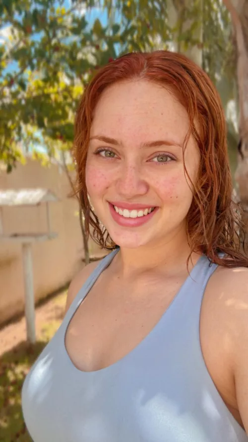 My freckles are everywhere now