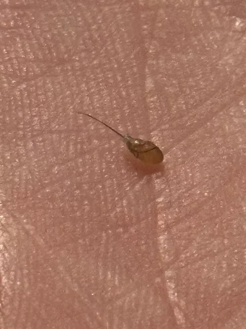 Absolutely disgusting ingrown hair that came out in one piece