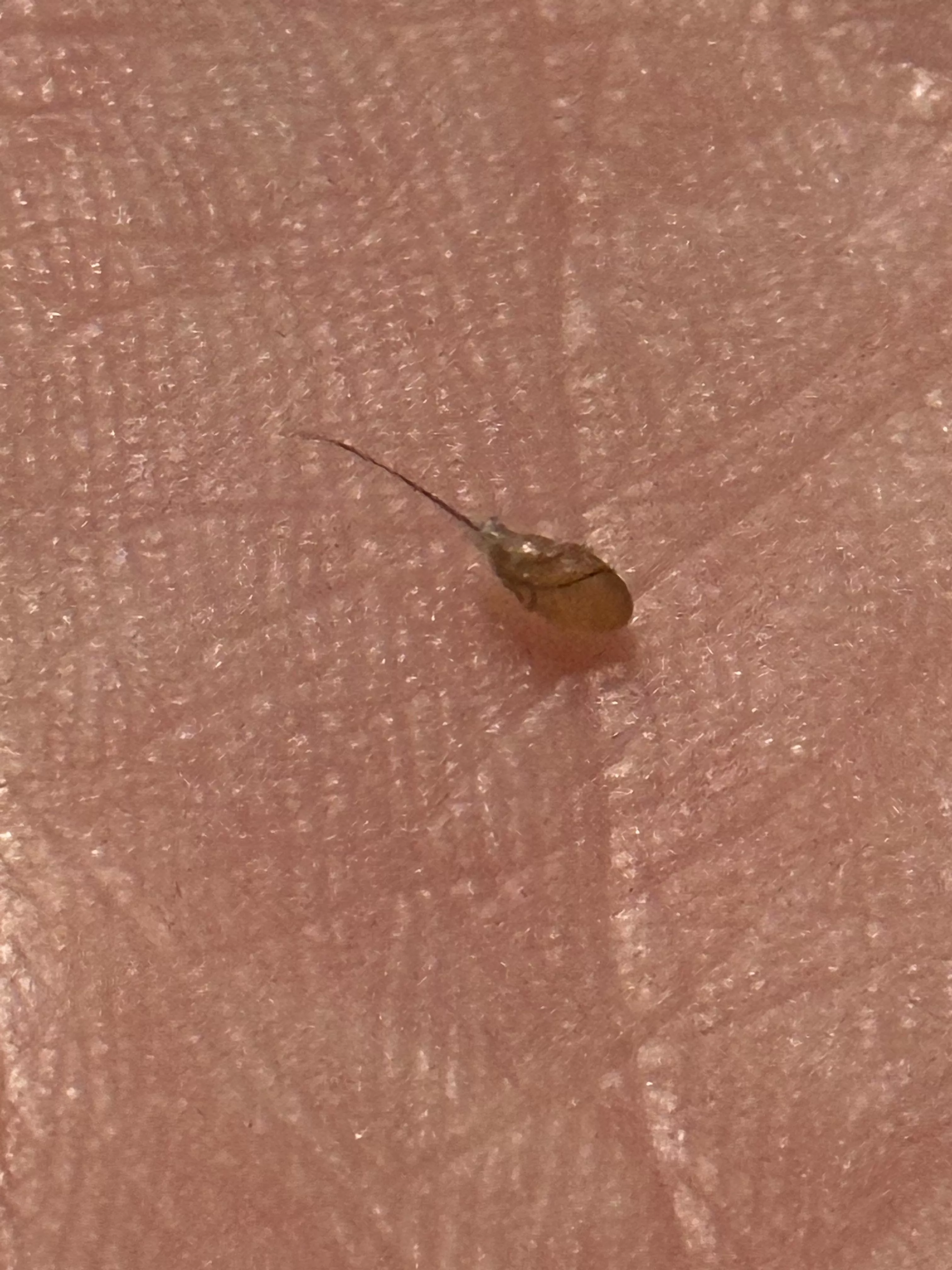 Absolutely disgusting ingrown hair that came out in one piece