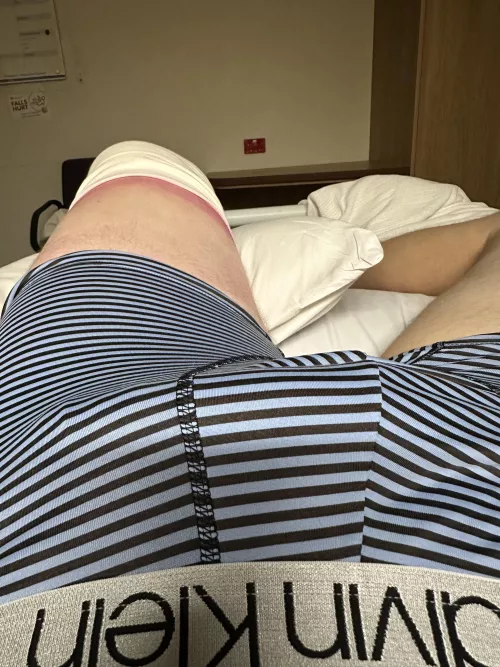 In hospital with a semi.