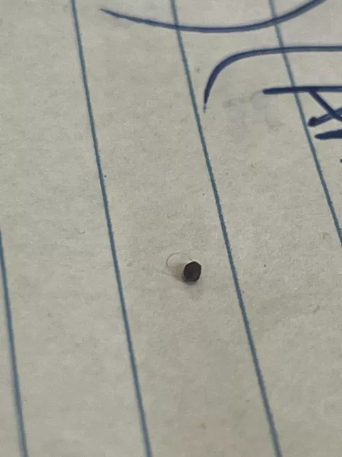Pubic Pebble From Ingrown Hair