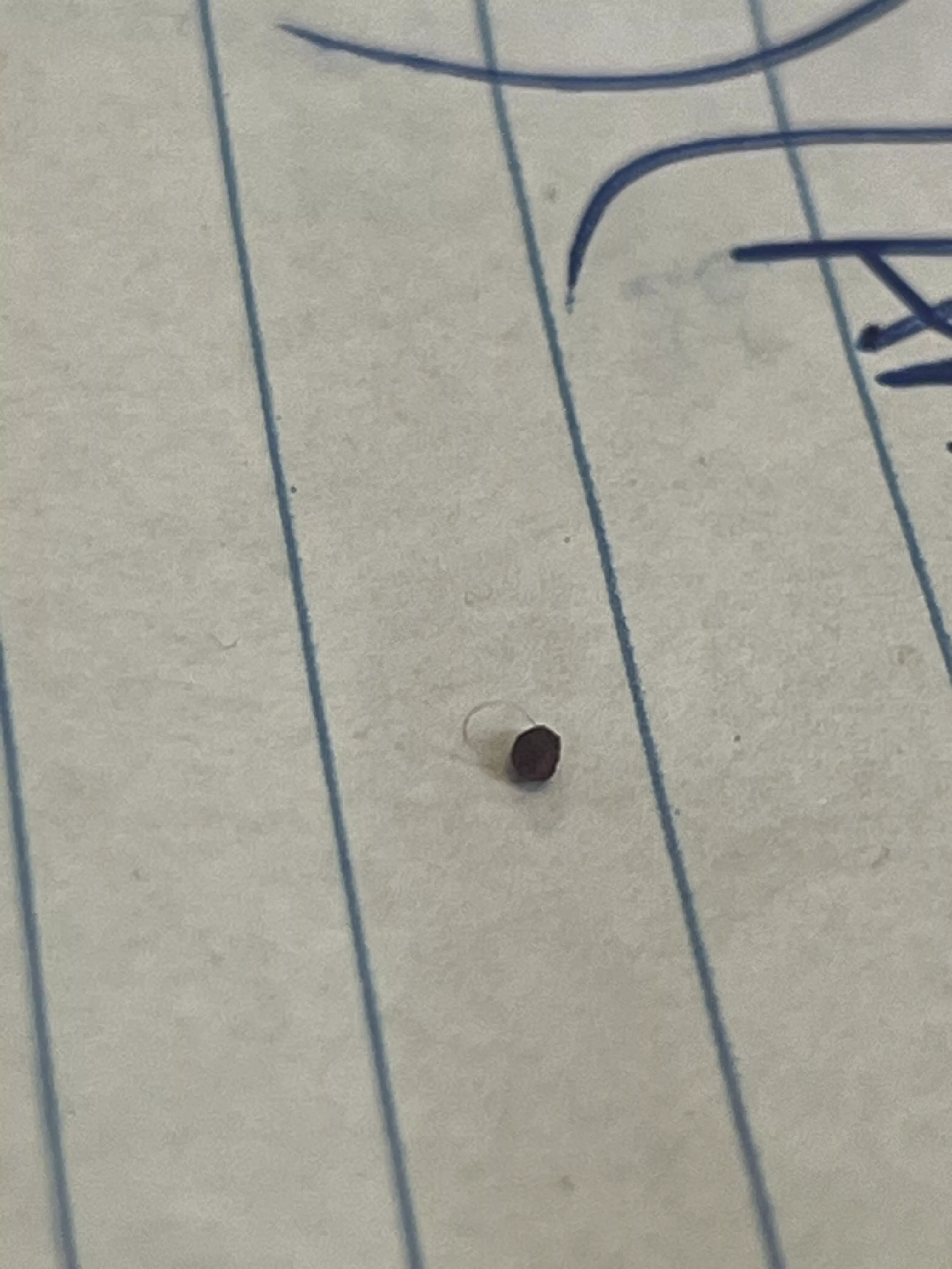 Pubic Pebble From Ingrown Hair