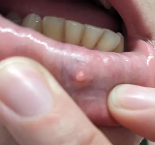 This frustrating thing looks poppable but it's not