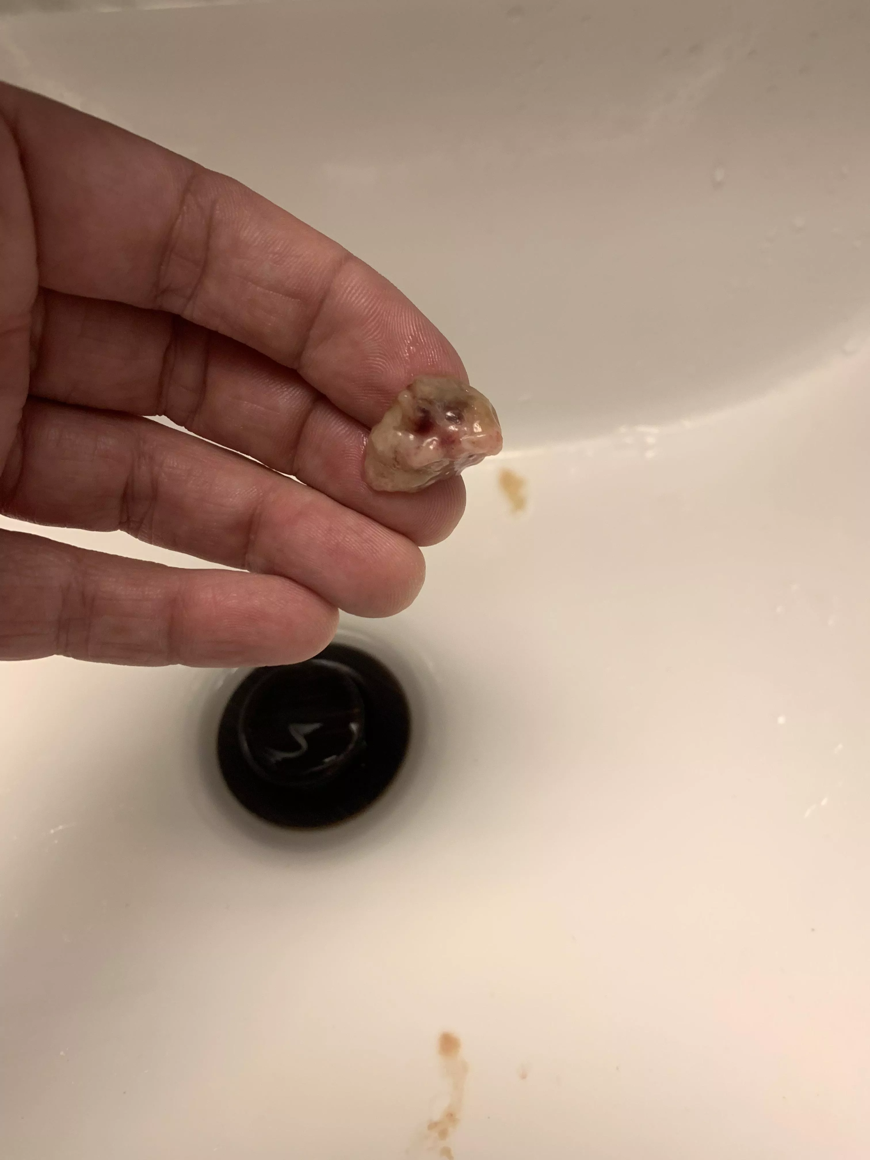 Was sick for a week 5 days of the worst sinusitis I’ve ever had. Coughed this up after nearly choking on it and came to post