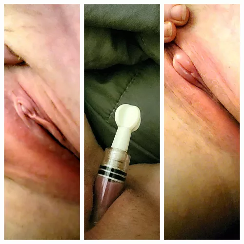 [F]ell asleep for a few hours with my pump on