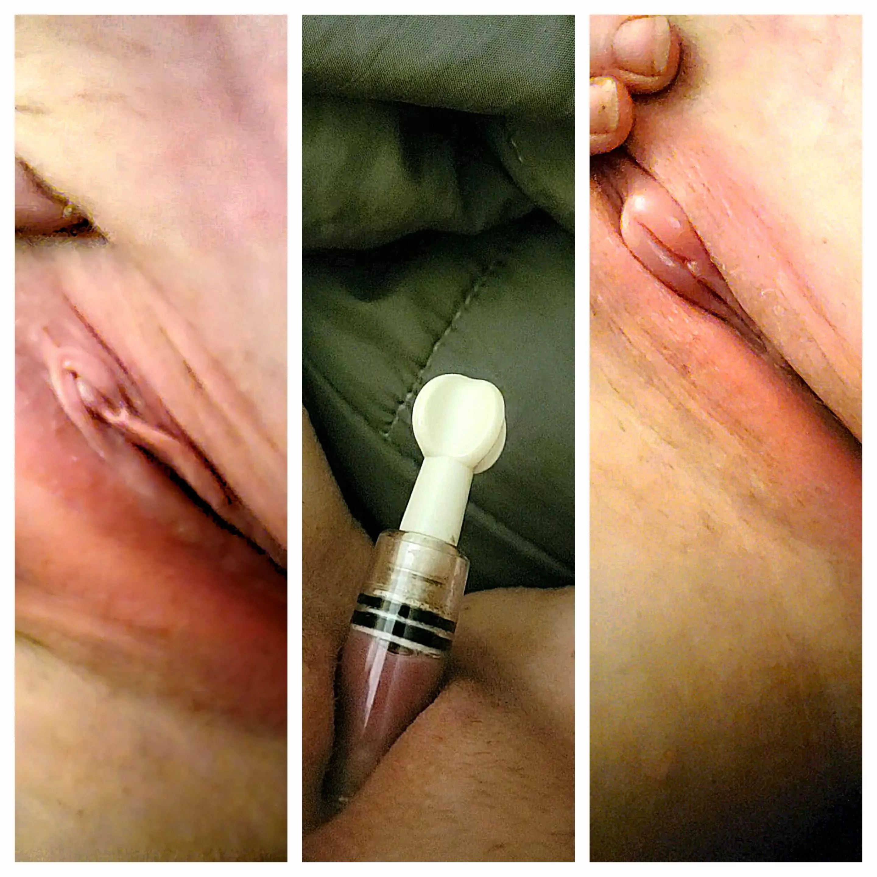 [F]ell asleep for a few hours with my pump on