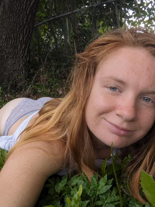 Freckle-Faced and Fabulous: Loving My Unique Look💖