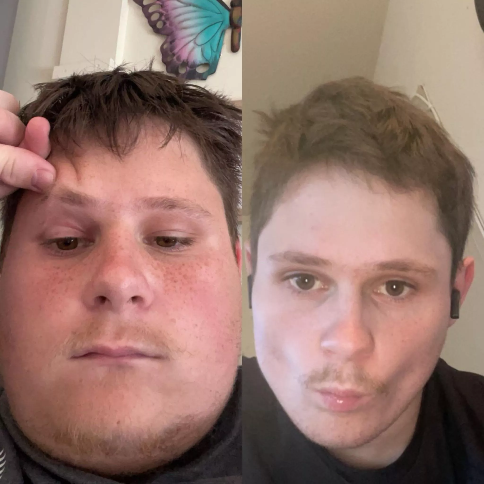 The change in my face after losing 35kg 😀