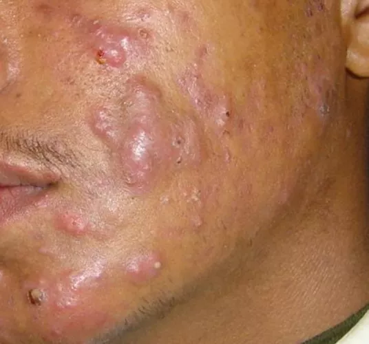 What are your perfect zen pops? What gives you that euphoric braingasm?