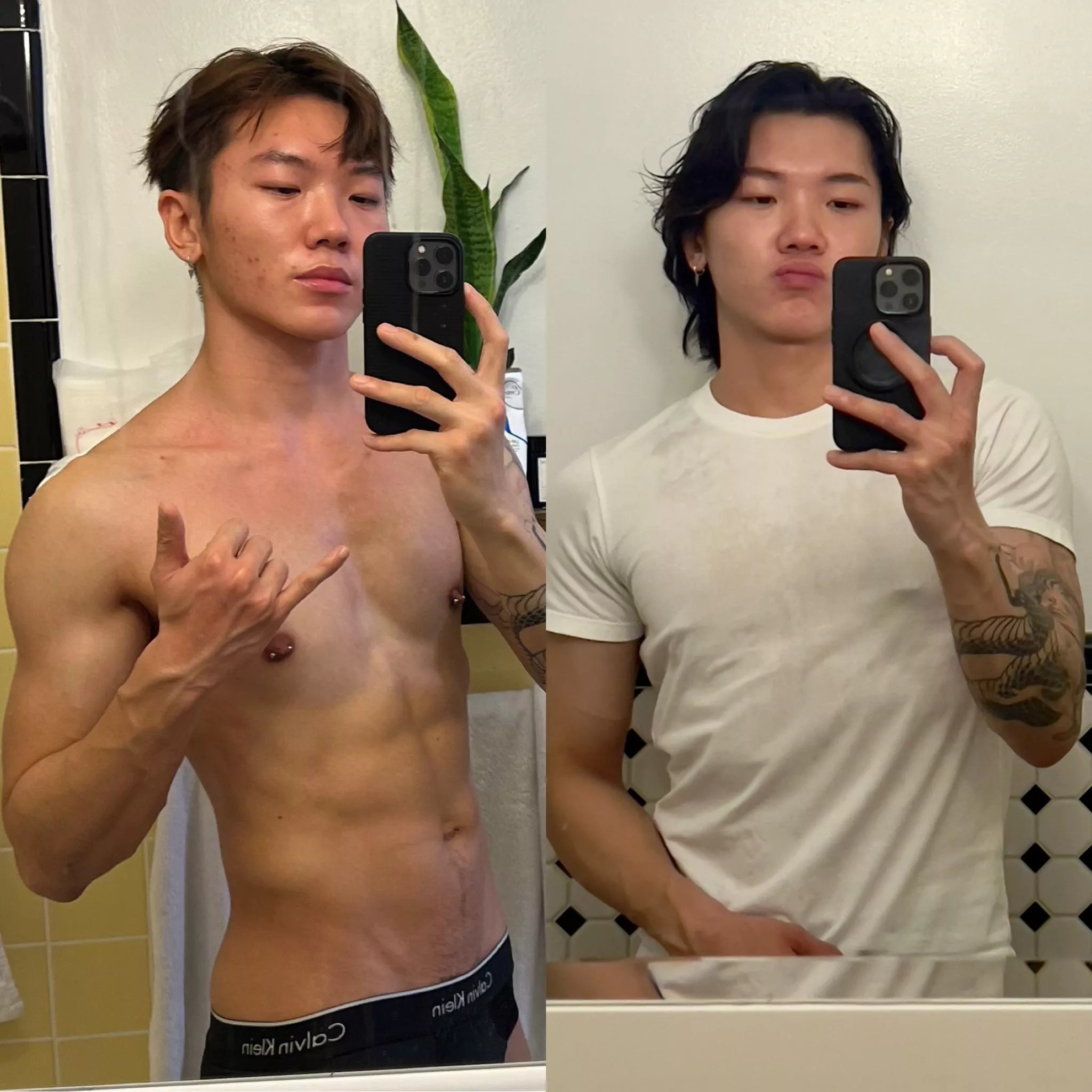 11months to clear up my face - happy sunday