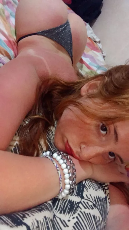 A little too much sun...