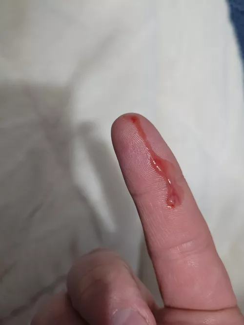 Felt something on my bum. Quick squeeze and bam!