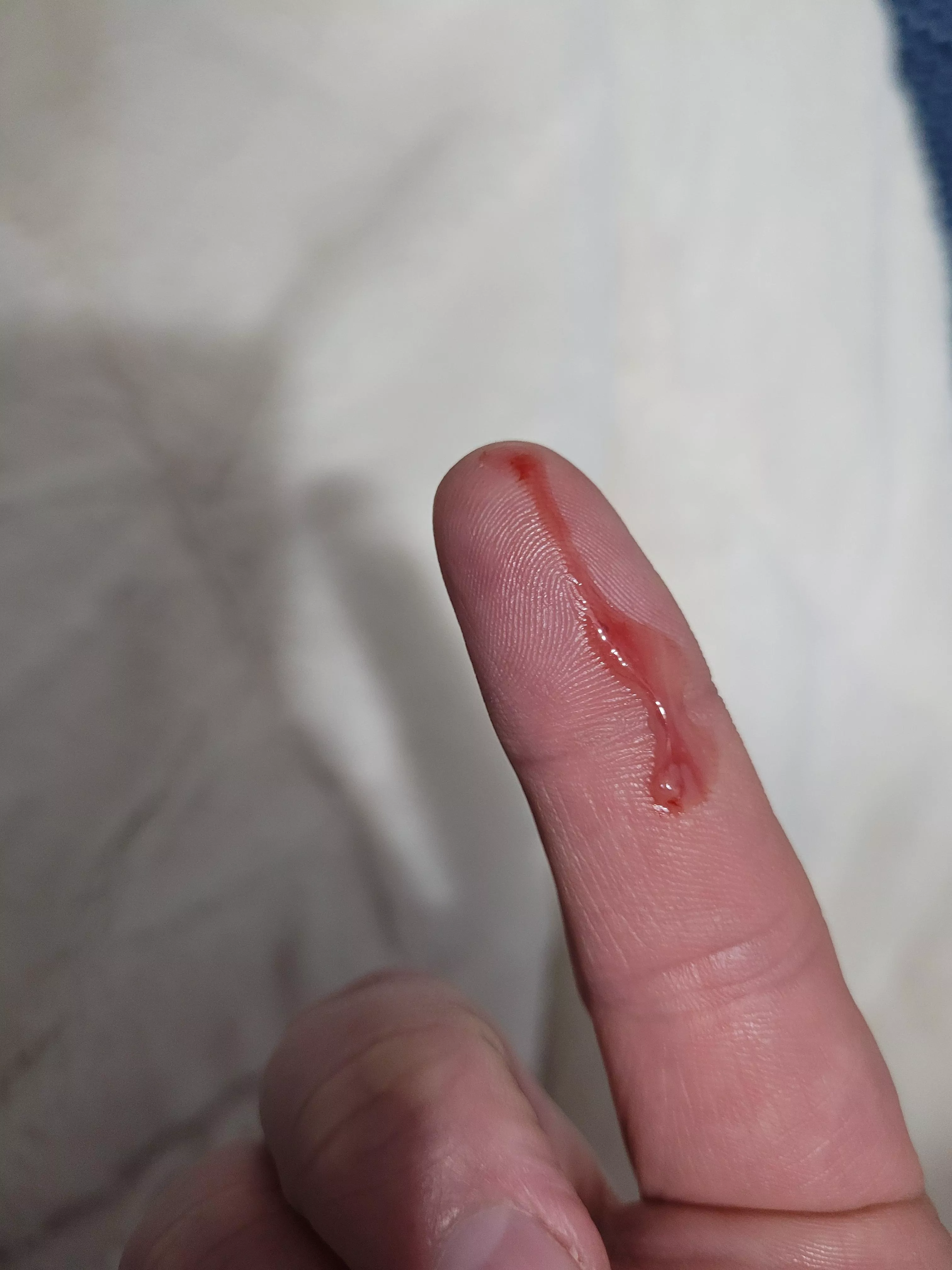 Felt something on my bum. Quick squeeze and bam!