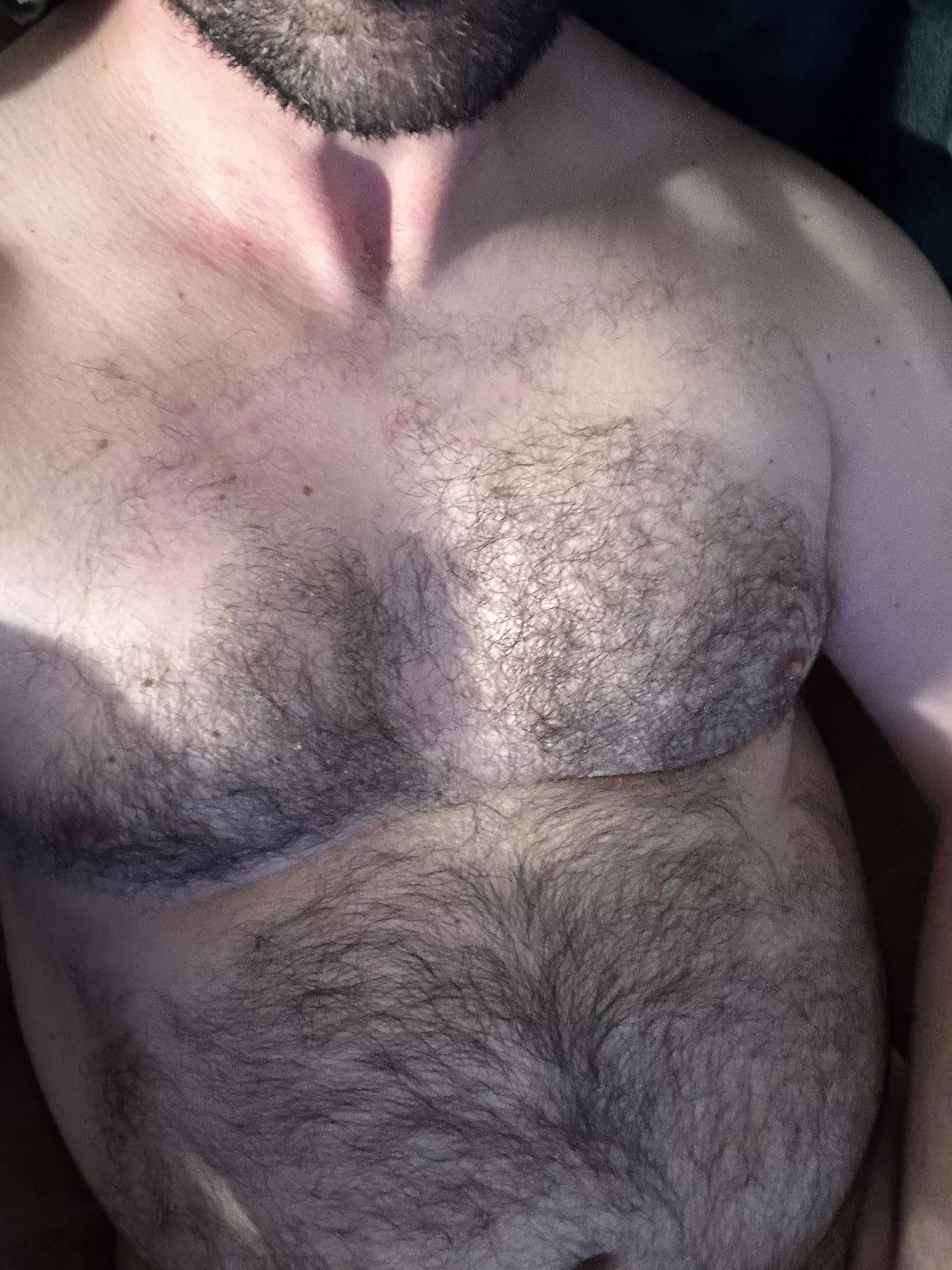 The beard has grown back