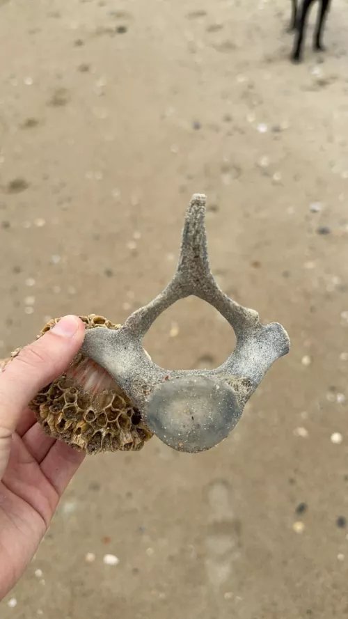 What is this. Bone of what??