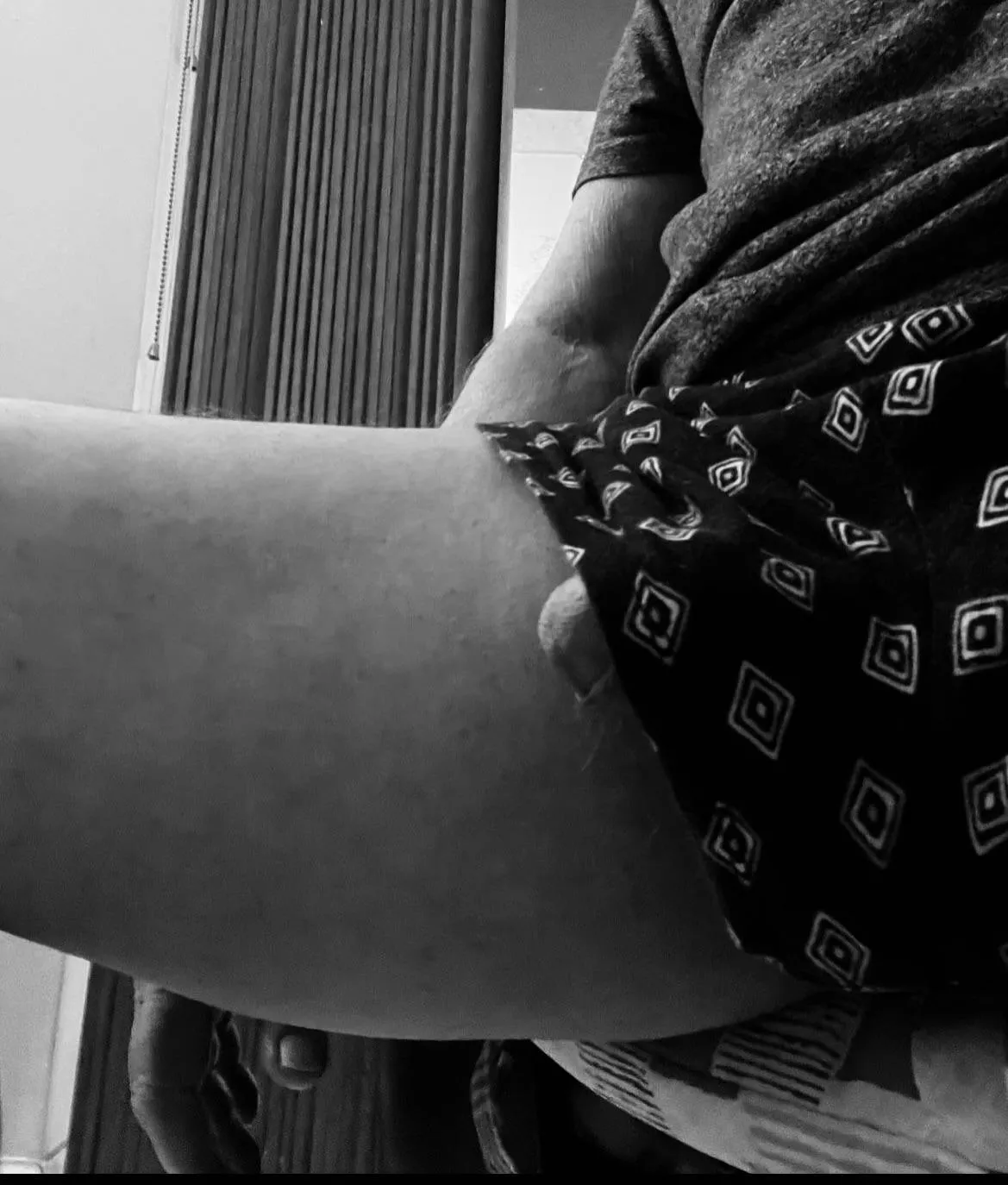 A “Freudian” slip