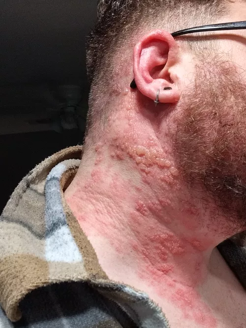 Forbidden pops for days(OC)