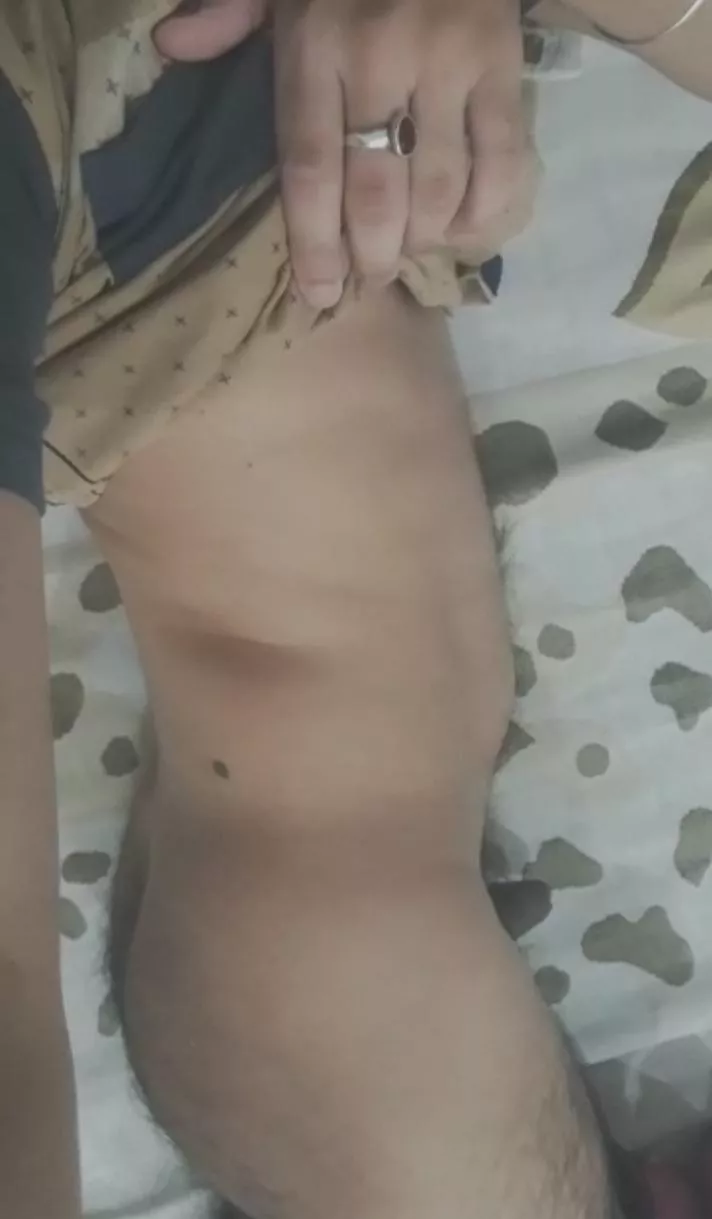 What would you do if you saw me like this?