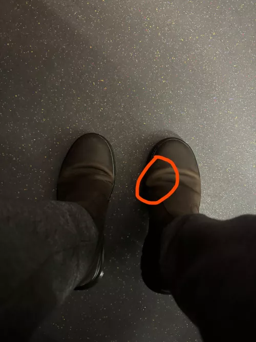 Bad crease/folding, hurts the foot when bent while walking