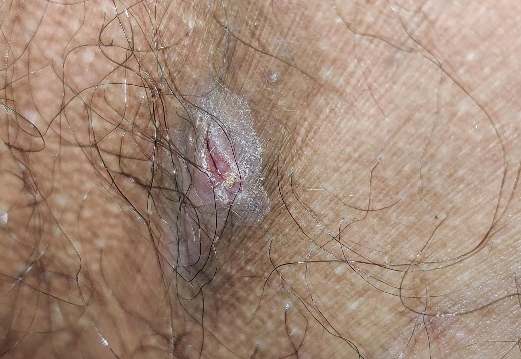 Is this normal healing process?