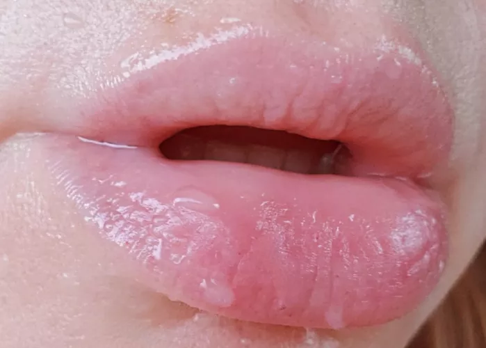 On the 6th day of Christmas, my true love gave...