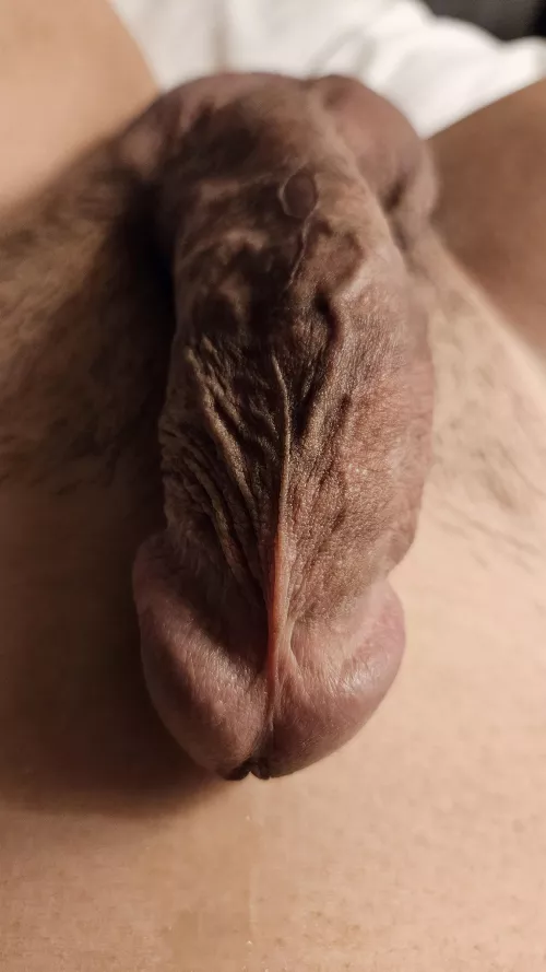 What do u think about my circumcised penis?
