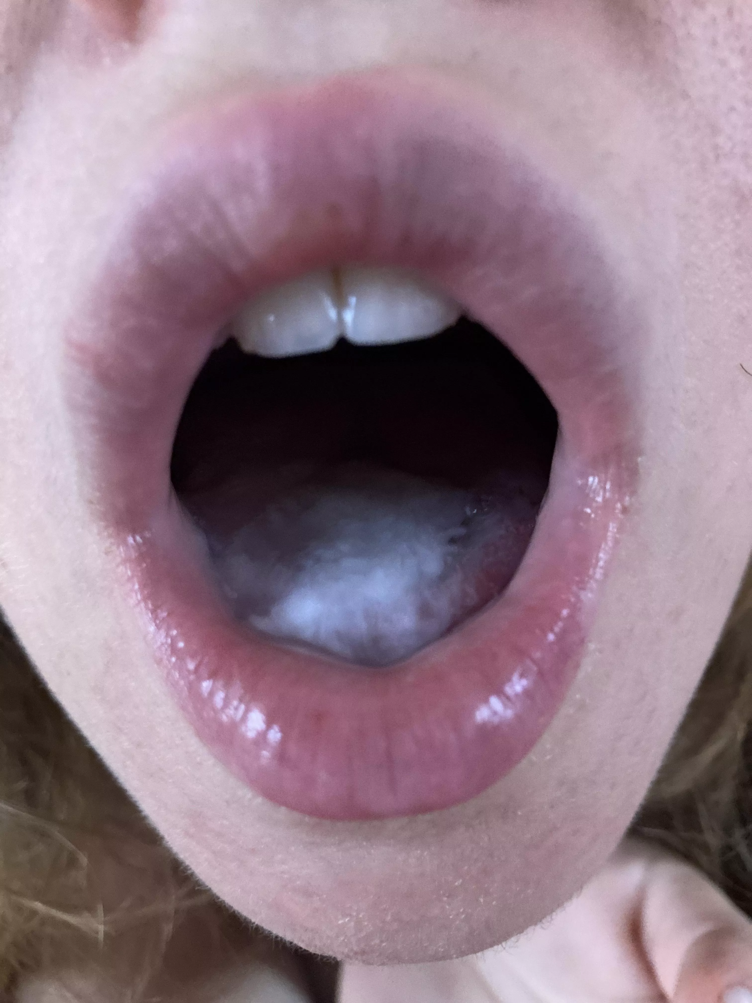 Getting my daily vitamin D straight in my mouth