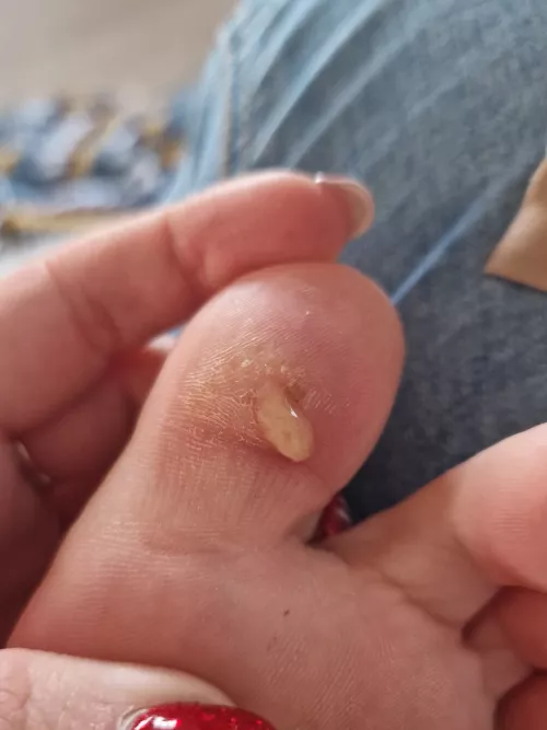 Oh dear it got infected. (Yes I promise I'll film it next time)