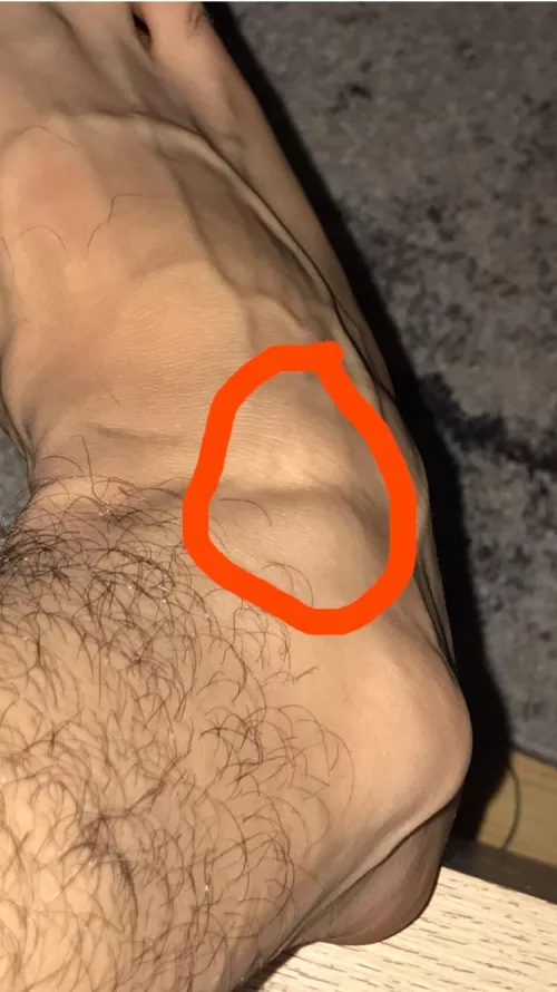 What is this on my foot??