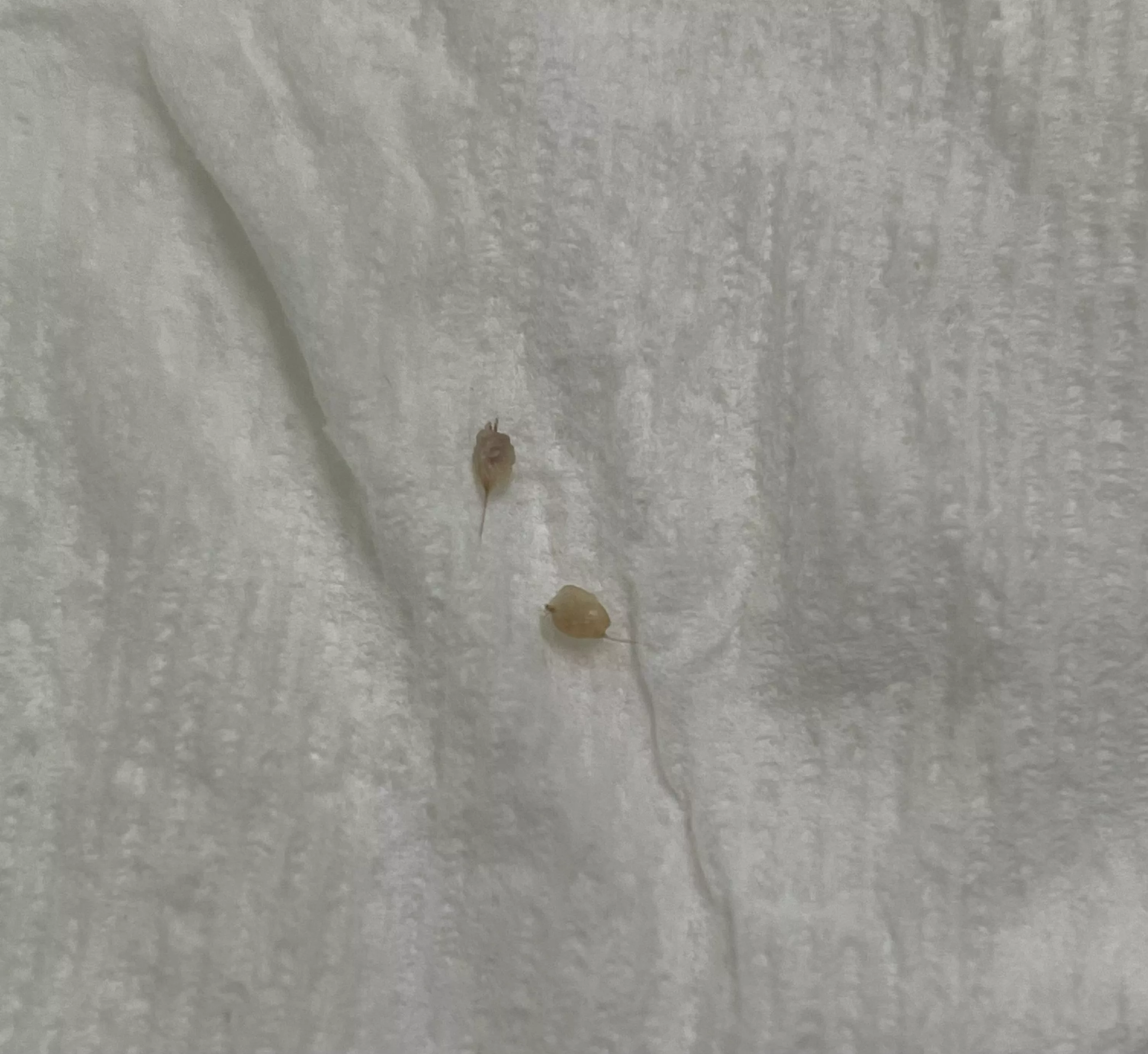 After 4 months of having these two painful small bumps on each of my buttcheeks, I am free