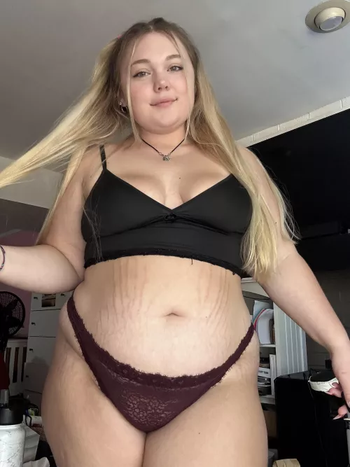 Are all the stretch marks a turn off