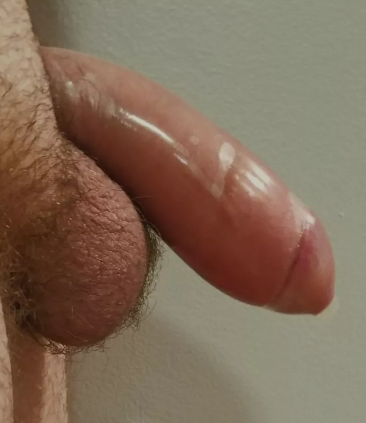 Testing condo[m]s