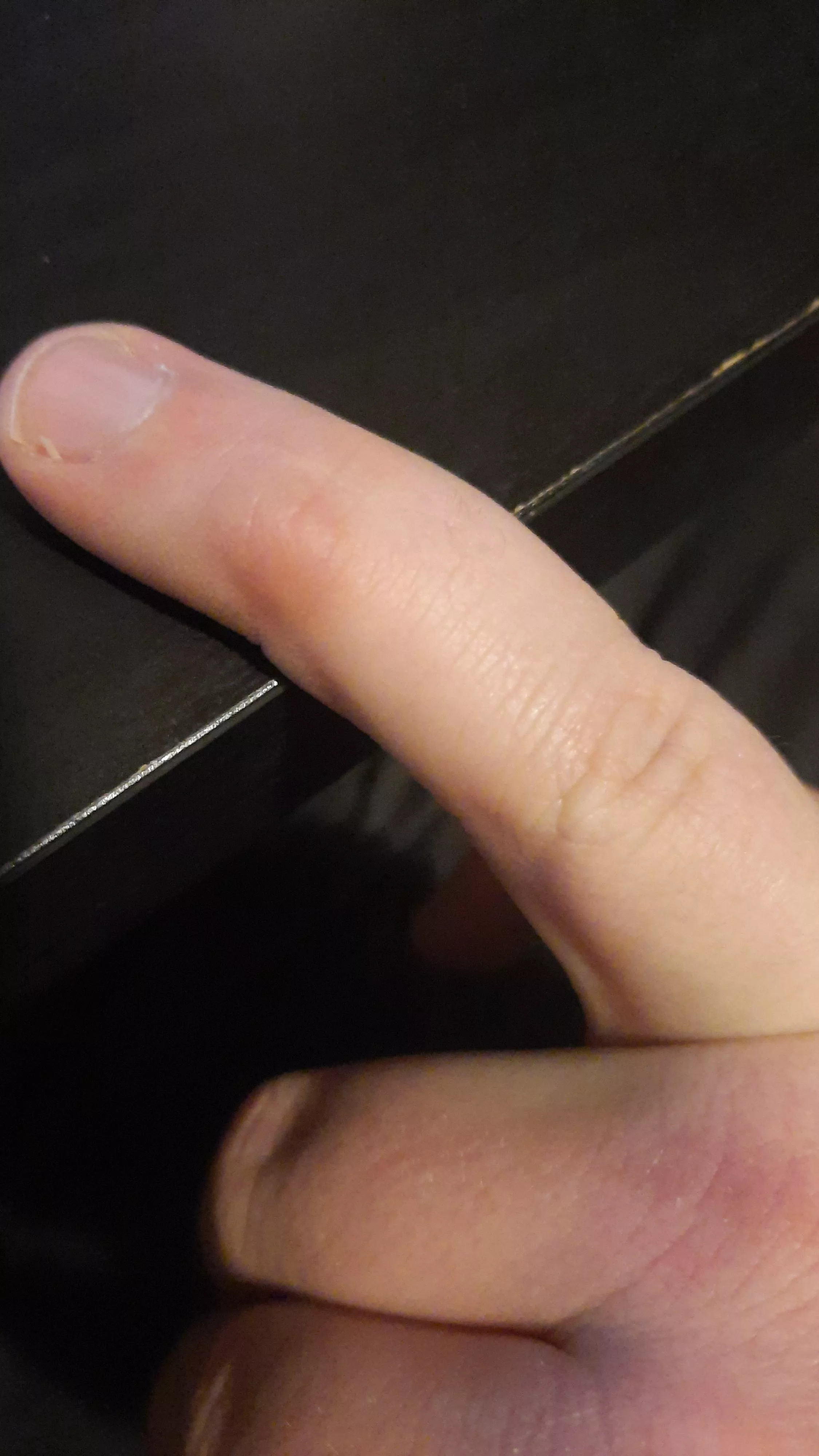 2 decade old blister