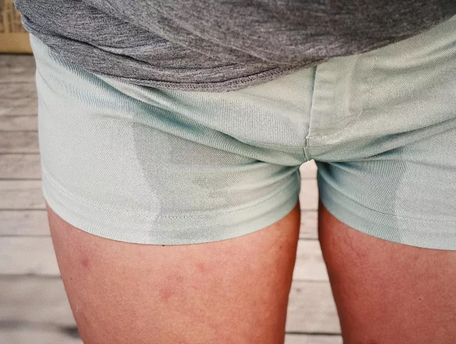 Do you want to see more?