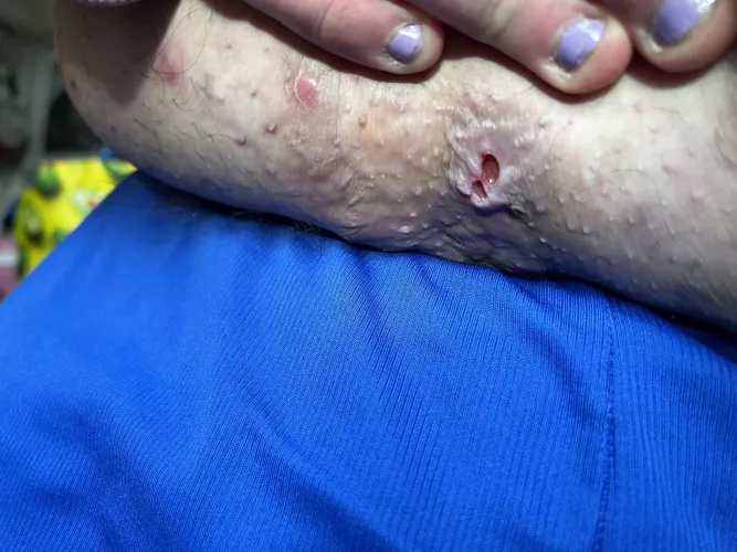 Nasty thing under stomach