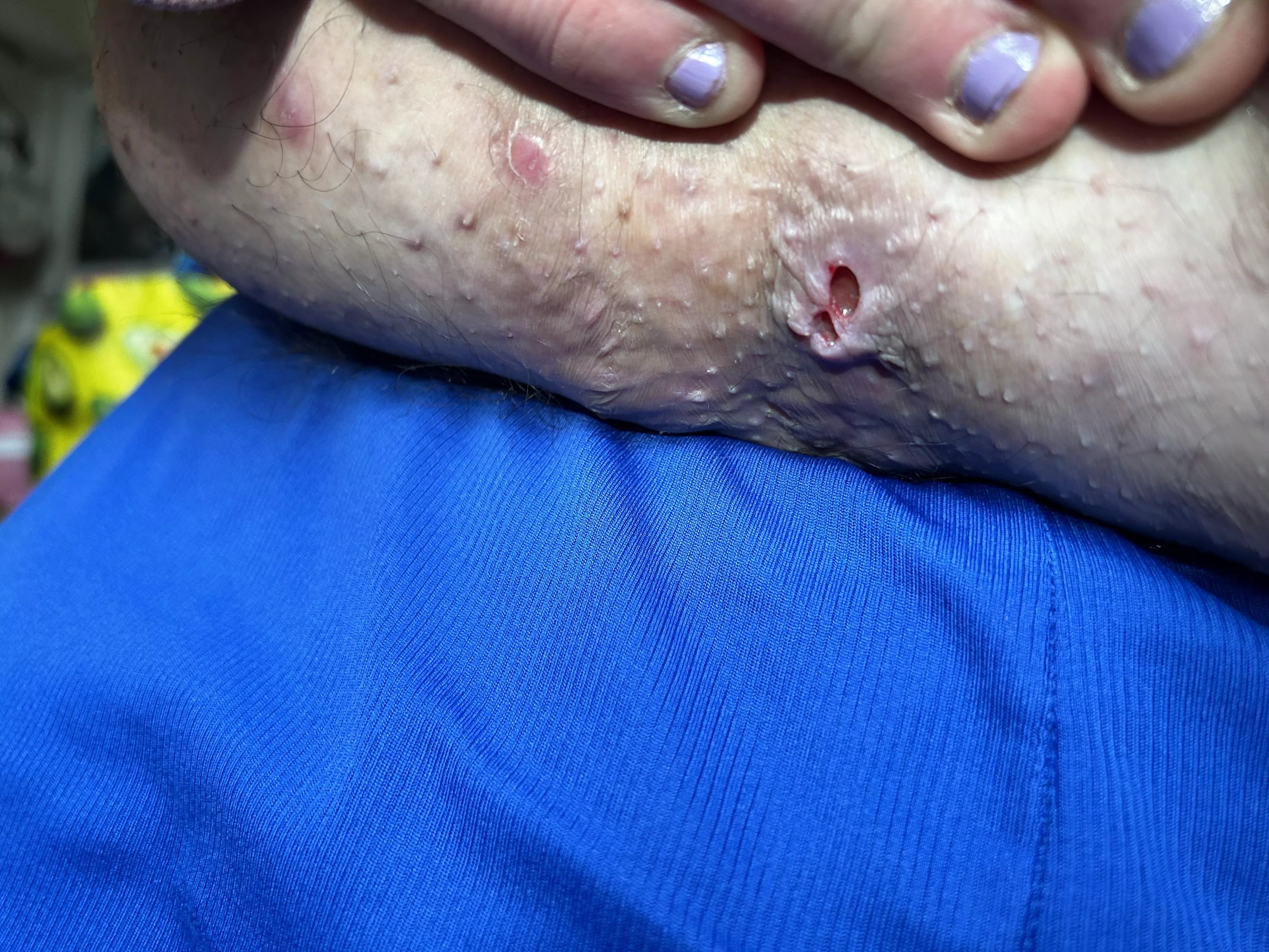 Nasty thing under stomach