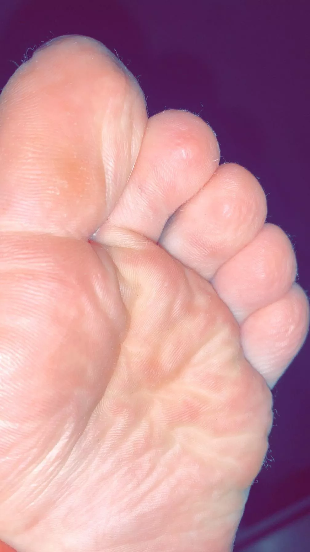 Omg my feet are so sweaty. Who wants to taste?