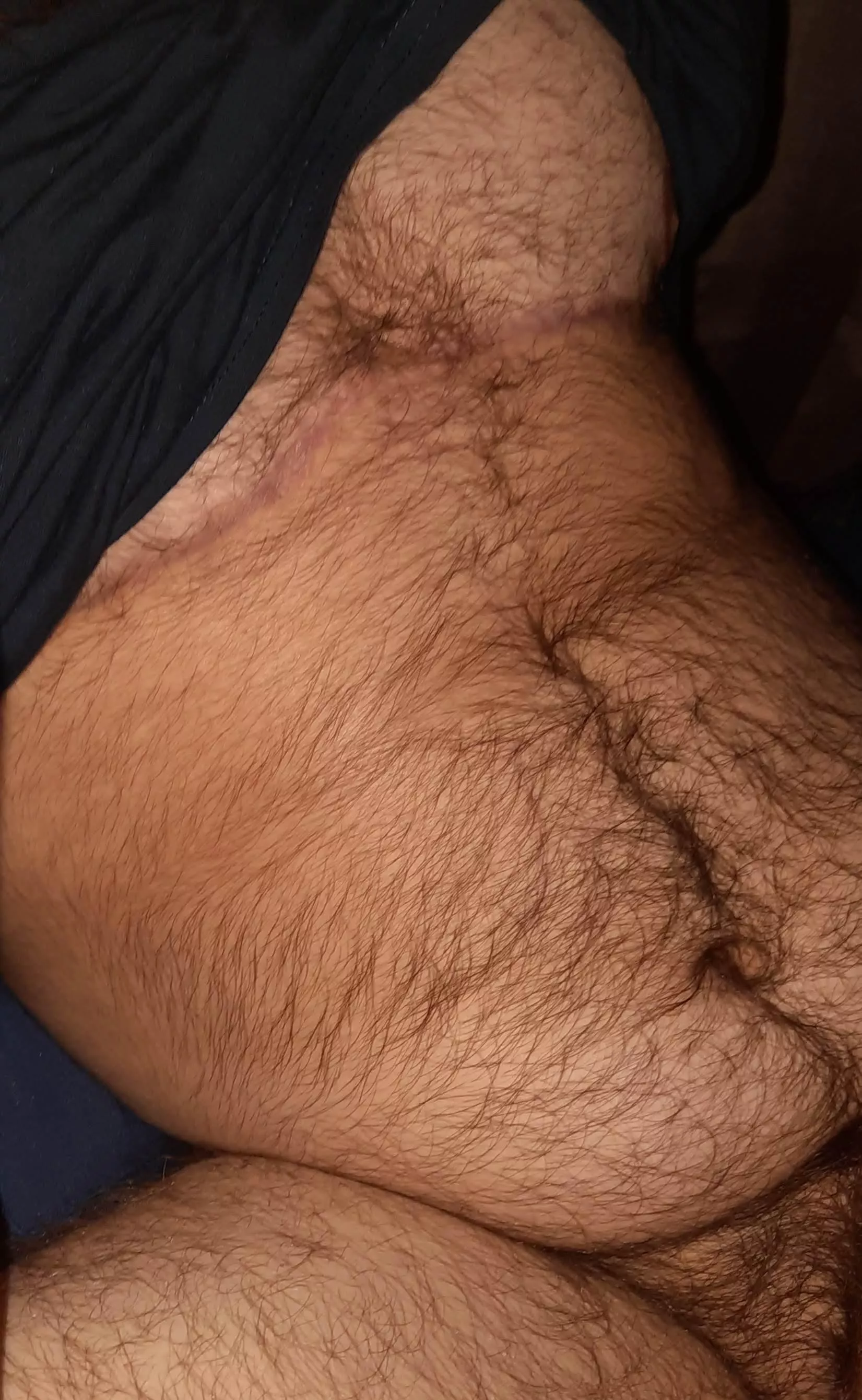 I've gotten even hairier since I took this but I still like it hope you do too!