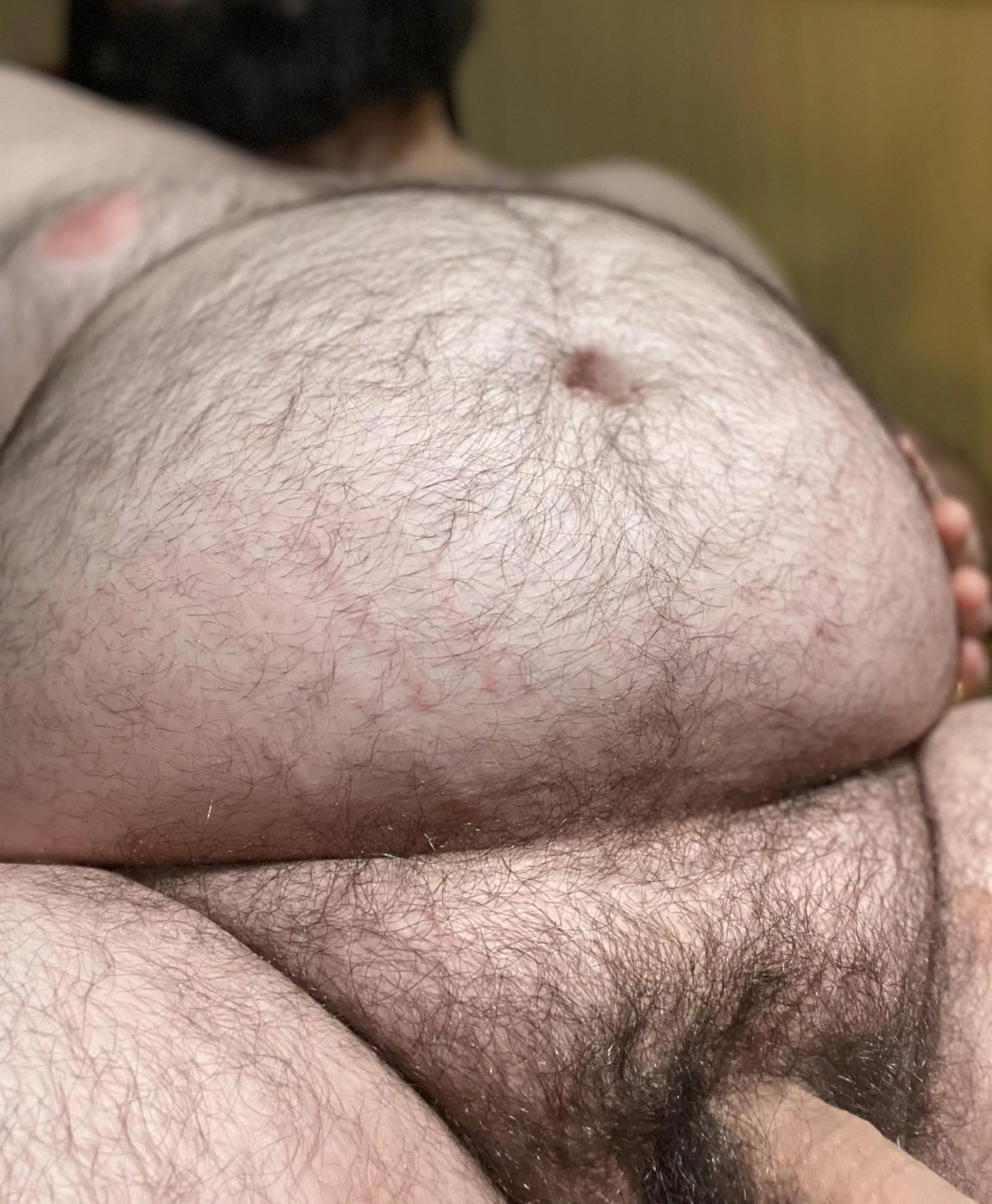 My Not So Sneaky Stretchmarks