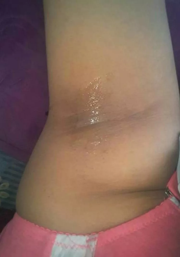 My roomie has turned the heater on full from her room. Woke up like this🙄