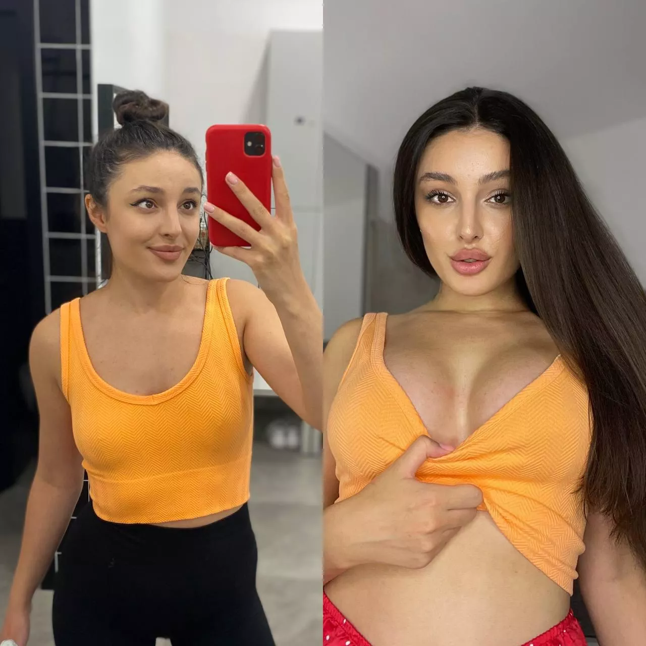 The more I look at my progress, the more surgeries I want