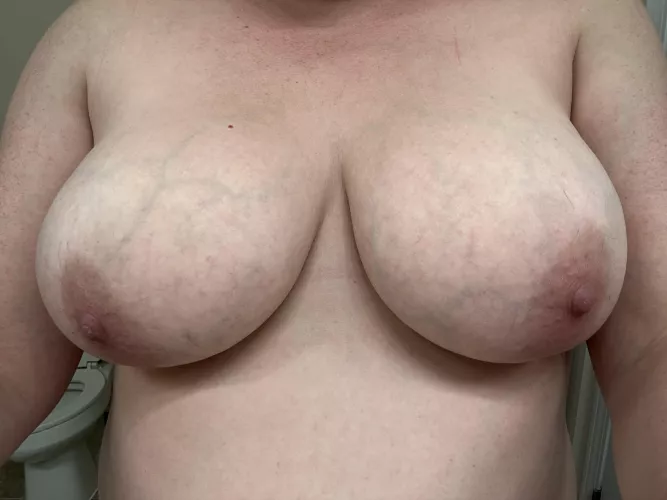 Be honest! Rate my mommy boobs