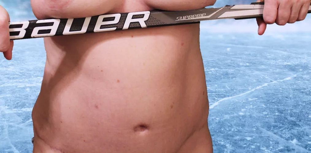 Did you want me to move that stick (36C)