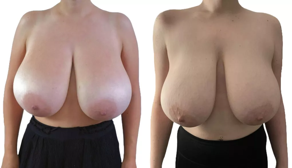 Do you prefer those on the right or those on the left ?