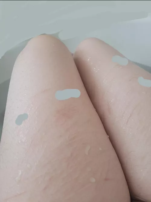 tw scars - had a nice lil bath today :3c