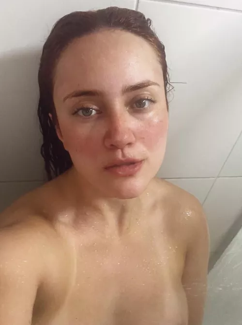 My eyes are up here. My freckles are everywhere. [IRTR]