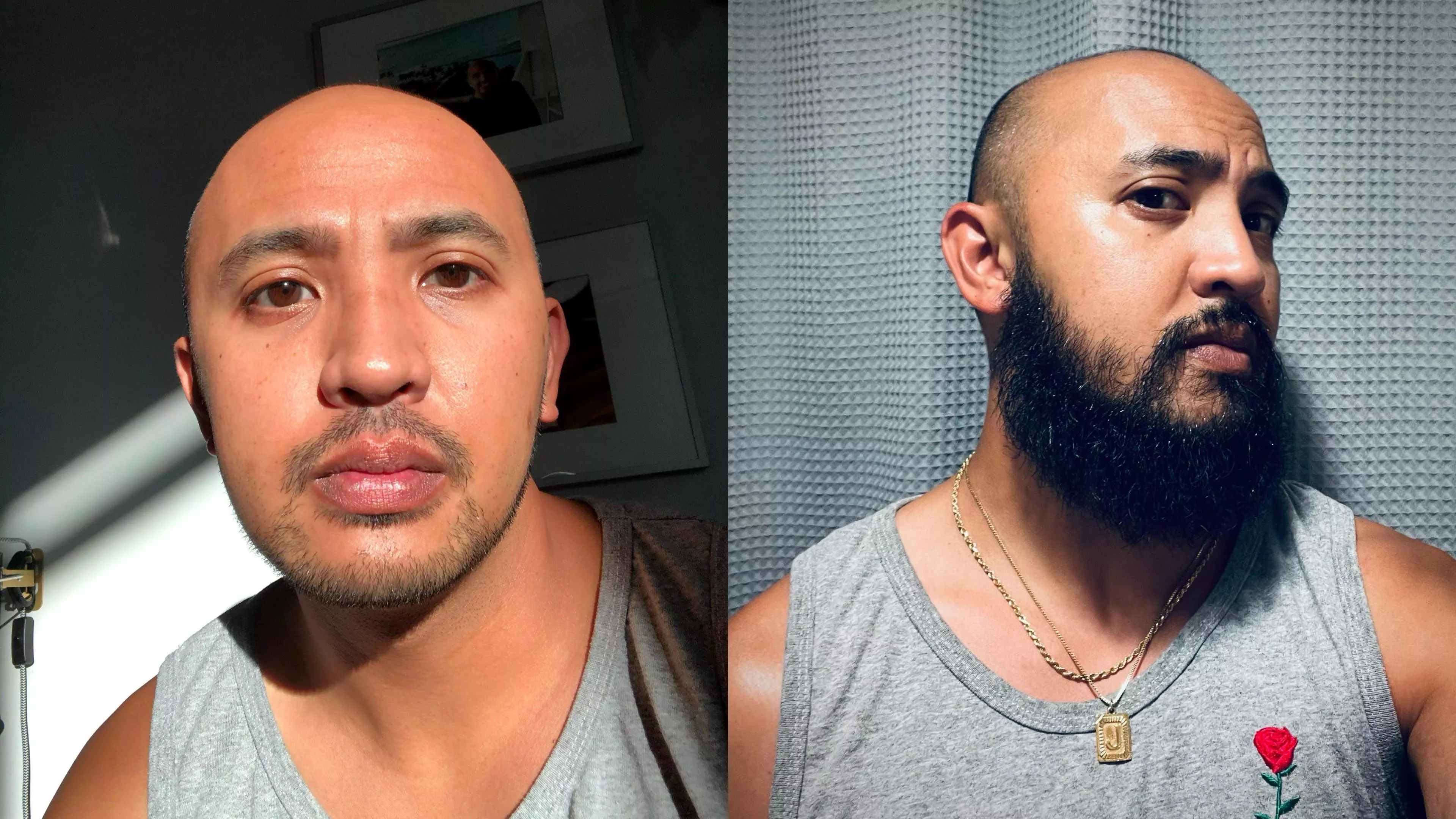 No beard vs beard