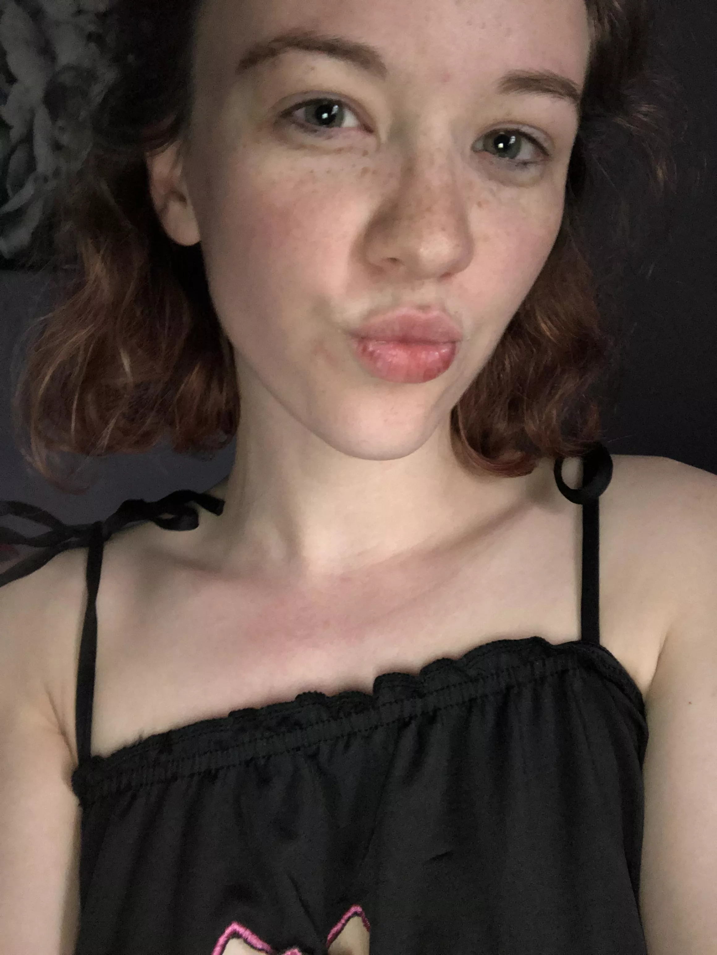 Freckles love kisses💋💋