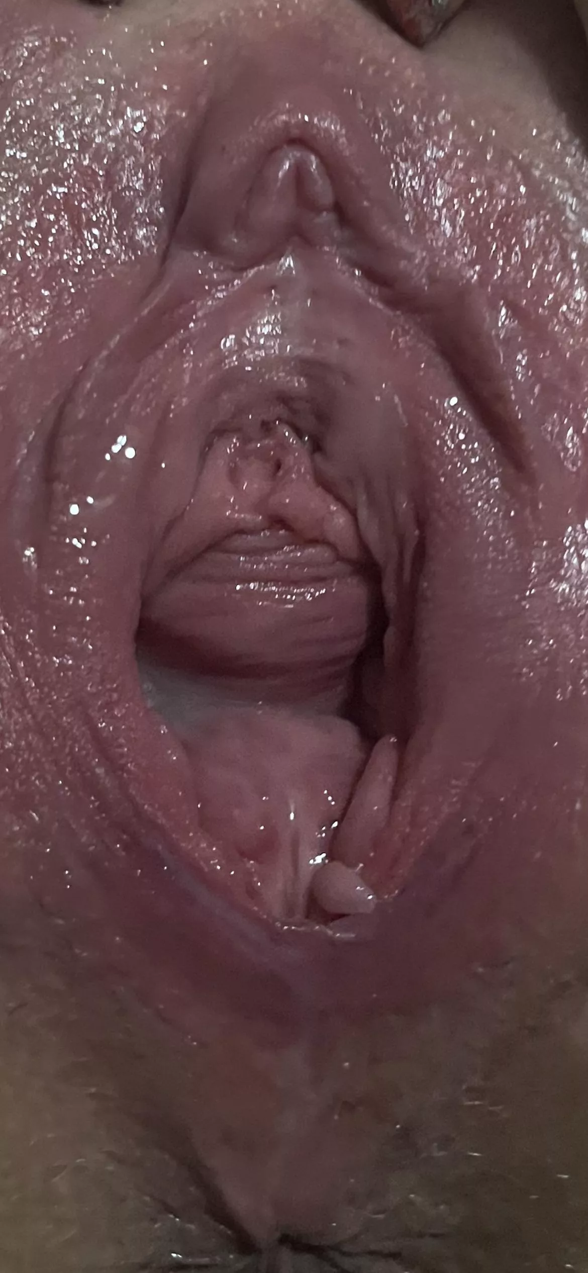 After fisting and clit pump