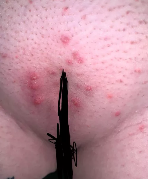 Got a Brazilian 8 days ago and this is what I’m left with